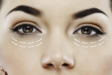 The Power of Blepharoplasty Surgery in New York City, NY